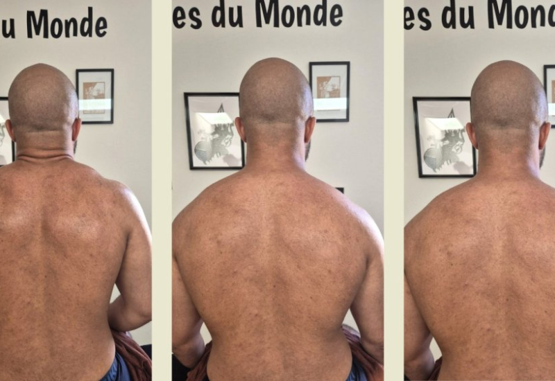 Formation massage Deep Tissue - Villefranche-sur-Saône - Naturelia