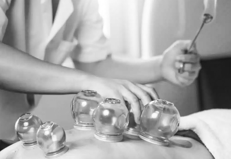 Formation Tui Na minceur avec ventouses - Naturelia - Villefranche-sur-Saône