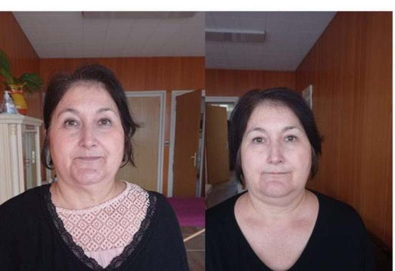 Dany avant après le kobido chez Naturelia formation kobido villefranche sur saône